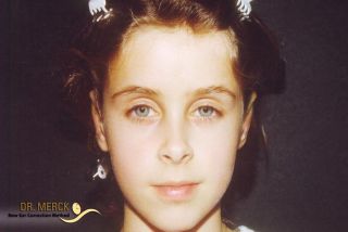 Ohren anlegen Bild nach OP 9 Korr